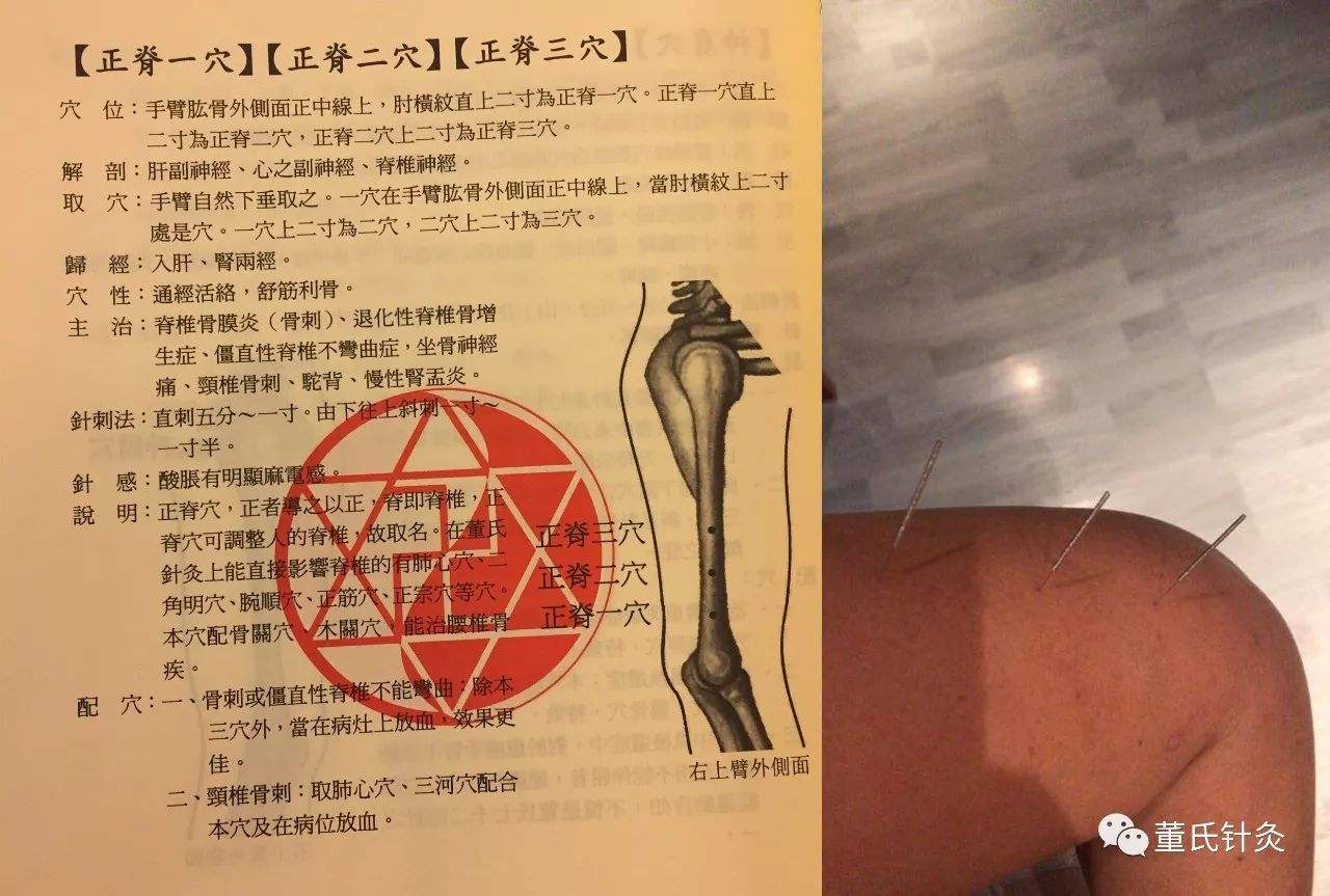 董氏针灸门户网手机版灸大夫经络穴位图解电脑版下载